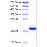 SDS-PAGE - Recombinant Human IL-10 Protein (C-terminal His Tag) (A330804) - Antibodies.com