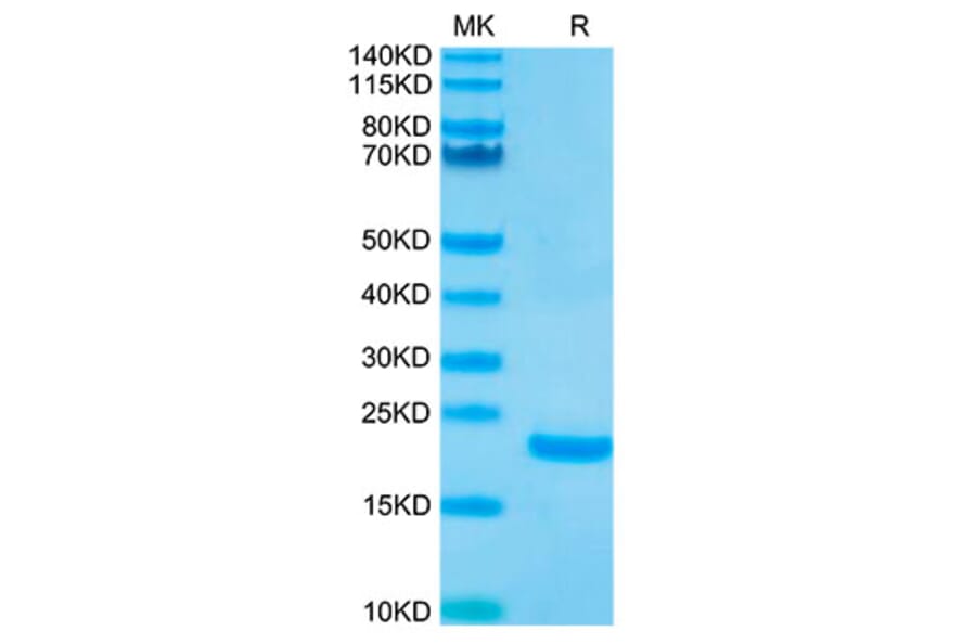 Tris-Bis PAGE - Recombinant Human IL-10 Protein (Biotin) (N-terminal His and Avi Tag) (A330805) - Antibodies.com