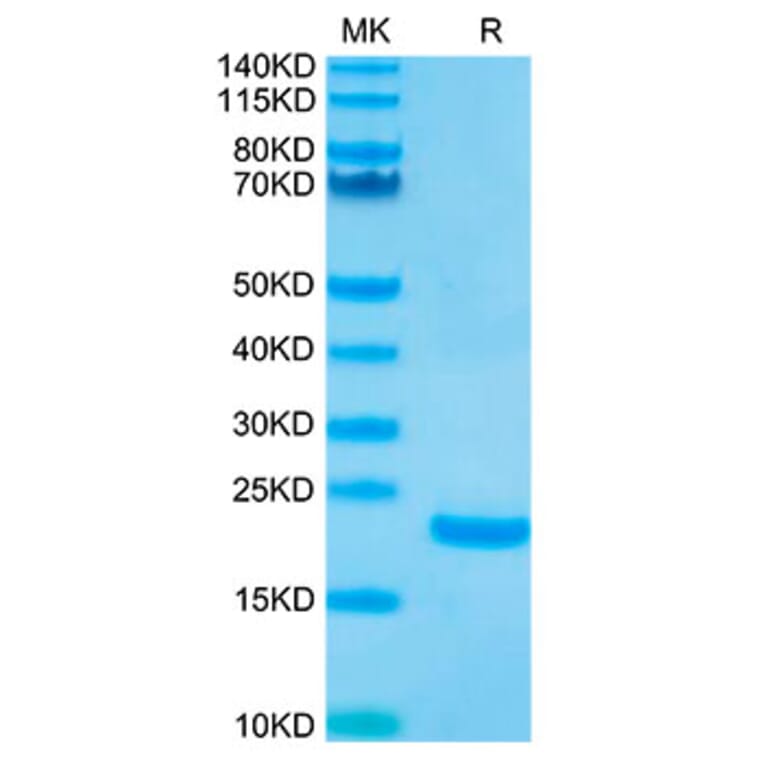 Tris-Bis PAGE - Recombinant Human IL-10 Protein (Biotin) (N-terminal His and Avi Tag) (A330805) - Antibodies.com