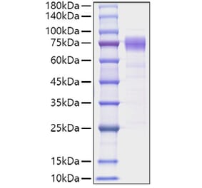 SDS-PAGE - Recombinant Human IL10RA Protein (C-terminal Human Fc Tag) (A330806) - Antibodies.com