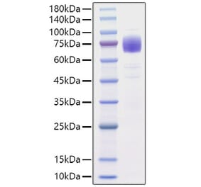SDS-PAGE - Recombinant Human IL10RA Protein (C-terminal Rabbit Fc Tag) (A330807) - Antibodies.com