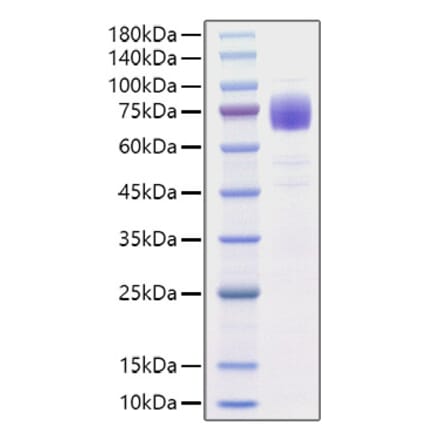 SDS-PAGE - Recombinant Human IL10RA Protein (C-terminal Rabbit Fc Tag) (A330807) - Antibodies.com