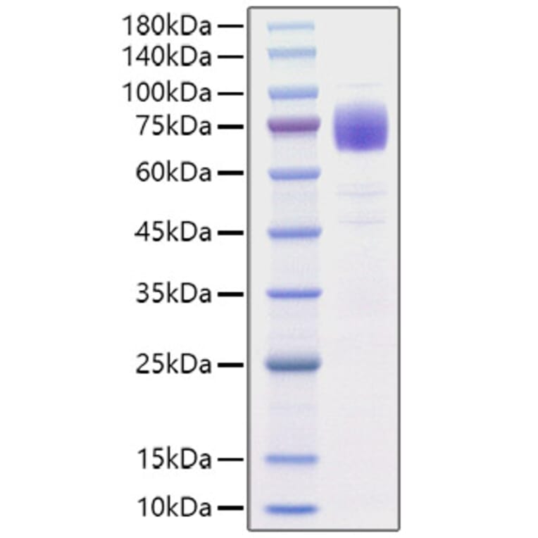 SDS-PAGE - Recombinant Human IL10RA Protein (C-terminal Rabbit Fc Tag) (A330807) - Antibodies.com