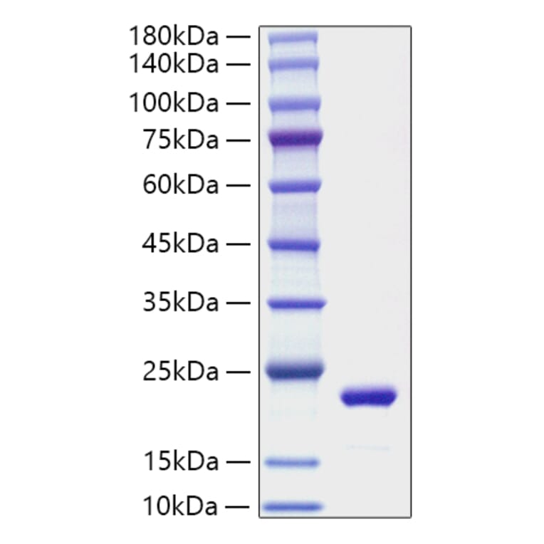 SDS-PAGE - Recombinant Mouse IL-11 Protein (A330808) - Antibodies.com