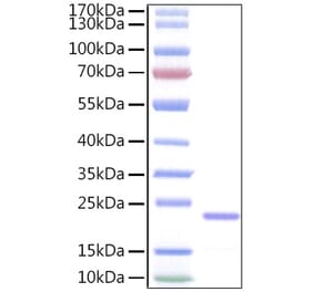 SDS-PAGE - Recombinant Human IL-11 Protein (A330809) - Antibodies.com