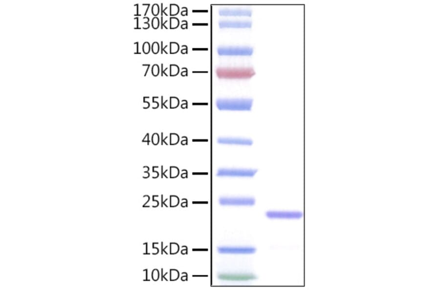 SDS-PAGE - Recombinant Human IL-11 Protein (A330809) - Antibodies.com