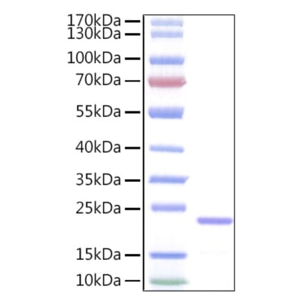 SDS-PAGE - Recombinant Human IL-11 Protein (A330809) - Antibodies.com