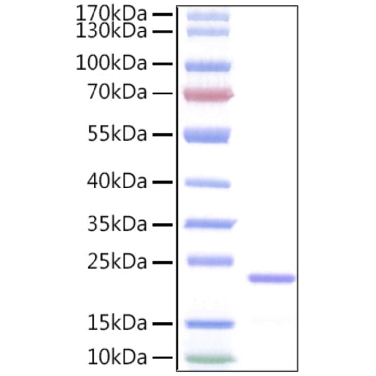 SDS-PAGE - Recombinant Human IL-11 Protein (A330809) - Antibodies.com
