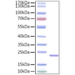 SDS-PAGE - Recombinant Human IL-11 Protein (A330809) - Antibodies.com