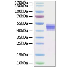 SDS-PAGE - Recombinant Human IL-12B Protein (C-terminal His Tag) (A330810) - Antibodies.com