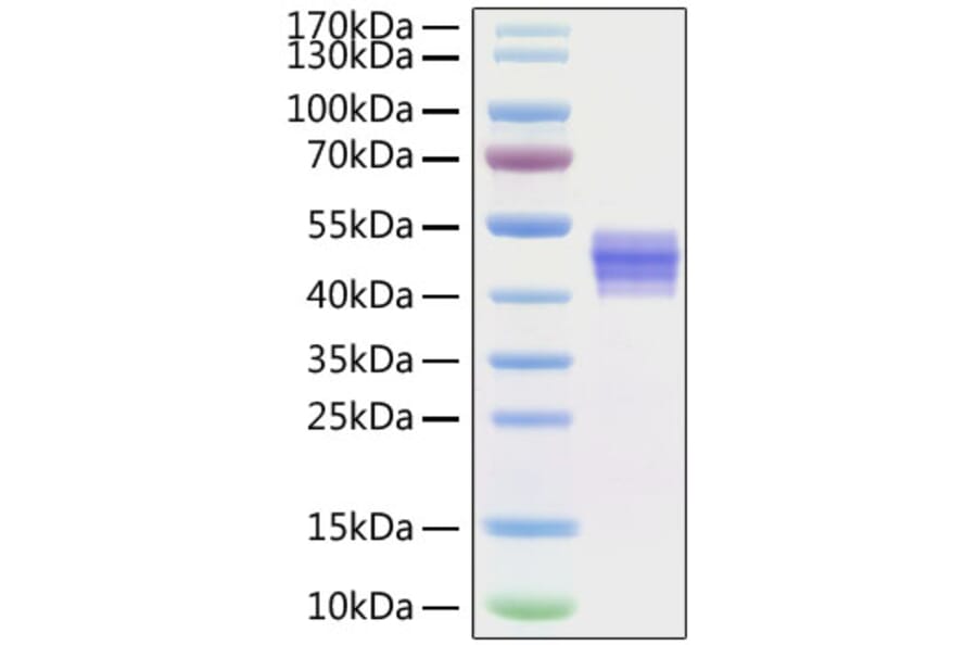 SDS-PAGE - Recombinant Human IL-12B Protein (C-terminal His Tag) (A330810) - Antibodies.com