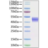 SDS-PAGE - Recombinant Human IL-12B Protein (C-terminal His Tag) (A330810) - Antibodies.com