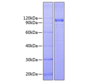 SDS-PAGE - Recombinant Human IL-12RB1 Protein (C-terminal Fc Tag) (A330811) - Antibodies.com