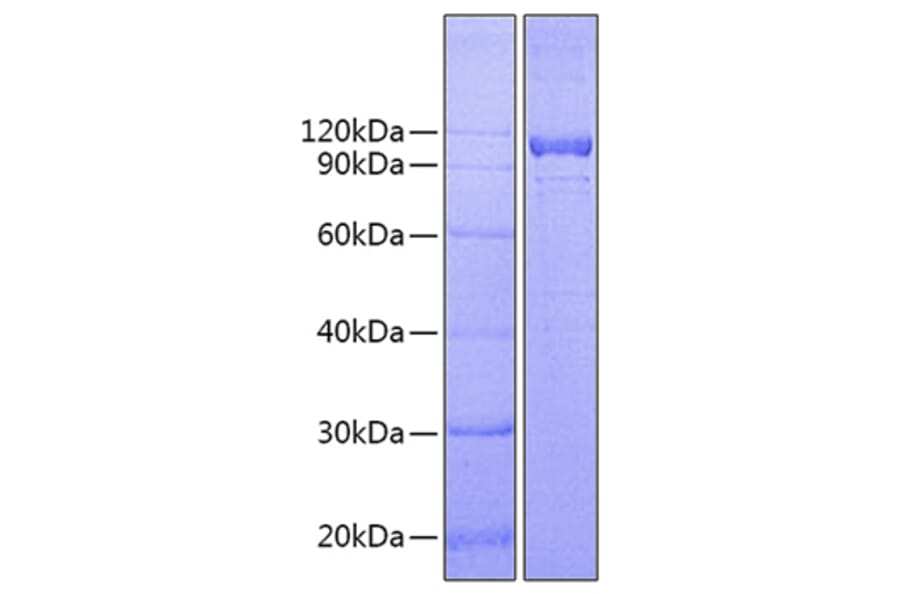 SDS-PAGE - Recombinant Human IL-12RB1 Protein (C-terminal Fc Tag) (A330811) - Antibodies.com