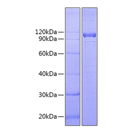 SDS-PAGE - Recombinant Human IL-12RB1 Protein (C-terminal Fc Tag) (A330811) - Antibodies.com
