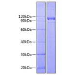 SDS-PAGE - Recombinant Human IL-12RB1 Protein (C-terminal Fc Tag) (A330811) - Antibodies.com