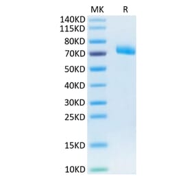 Tris-Bis PAGE - Recombinant Human IL-12RB1 Protein (C-terminal His Tag) (A330812) - Antibodies.com