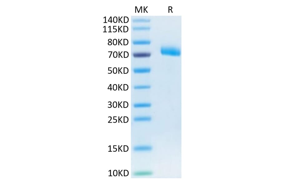 Tris-Bis PAGE - Recombinant Human IL-12RB1 Protein (C-terminal His Tag) (A330812) - Antibodies.com