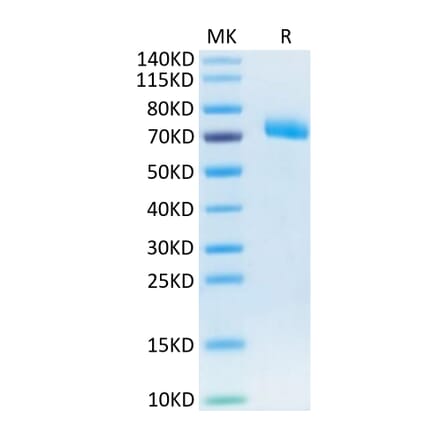 Tris-Bis PAGE - Recombinant Human IL-12RB1 Protein (C-terminal His Tag) (A330812) - Antibodies.com
