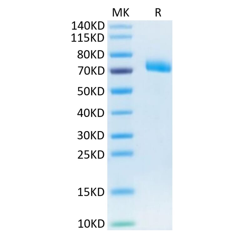 Tris-Bis PAGE - Recombinant Human IL-12RB1 Protein (C-terminal His Tag) (A330812) - Antibodies.com