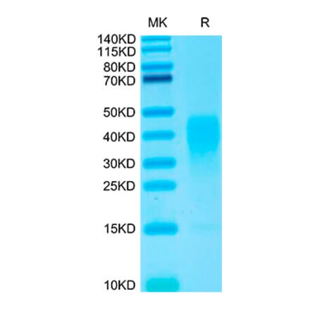 Tris-Bis PAGE - Recombinant Human IL-13 Protein (Biotin) (N-terminal His and Avi Tag) (A330813) - Antibodies.com