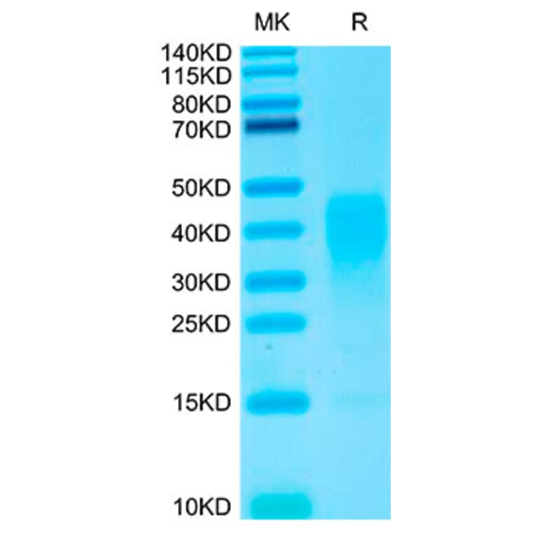 Tris-Bis PAGE - Recombinant Human IL-13 Protein (Biotin) (N-terminal His and Avi Tag) (A330813) - Antibodies.com