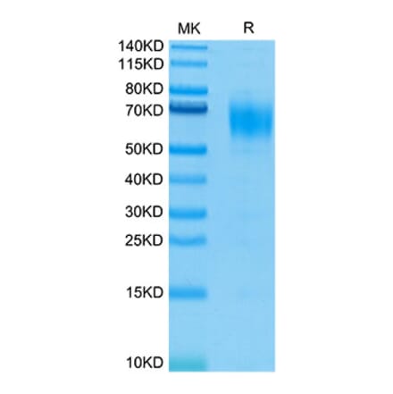 Tris-Bis PAGE - Recombinant Human IL-13 Receptor alpha 1 Protein (Biotin) (C-terminal His and Avi Tag) (A330818) - Antibodies.com