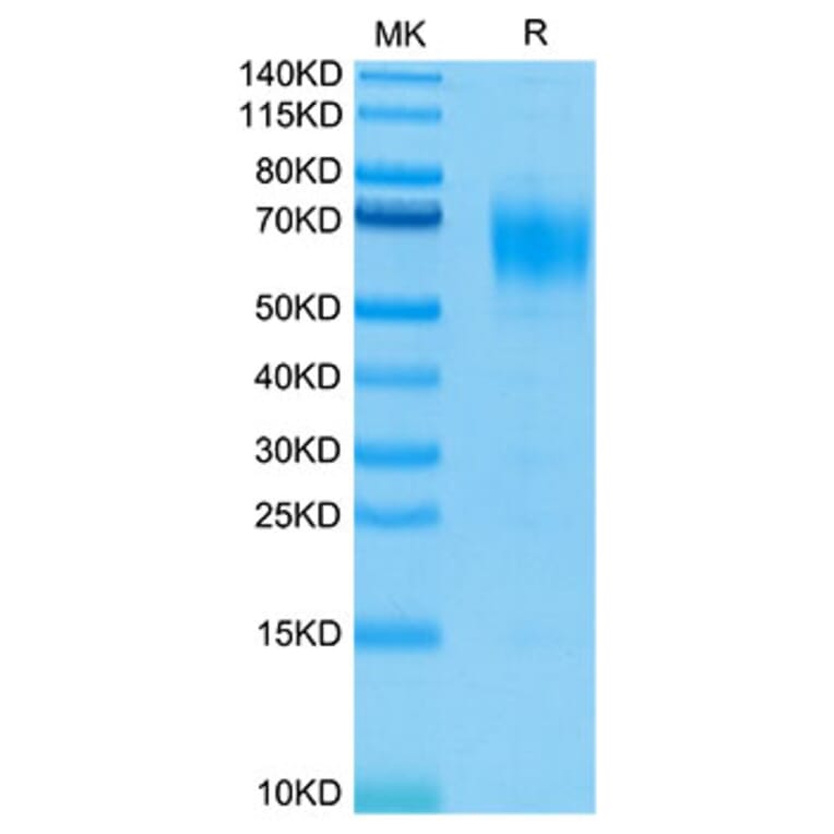 Tris-Bis PAGE - Recombinant Human IL-13 Receptor alpha 1 Protein (Biotin) (C-terminal His and Avi Tag) (A330818) - Antibodies.com