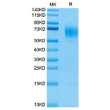 Tris-Bis PAGE - Recombinant Human IL-13 Receptor alpha 1 Protein (Biotin) (C-terminal His and Avi Tag) (A330818) - Antibodies.com