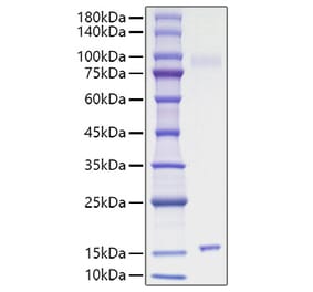 SDS-PAGE - Recombinant Mouse IL-15 Protein (C-terminal His Tag) (A330819) - Antibodies.com