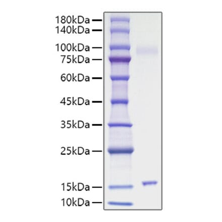 SDS-PAGE - Recombinant Mouse IL-15 Protein (C-terminal His Tag) (A330819) - Antibodies.com