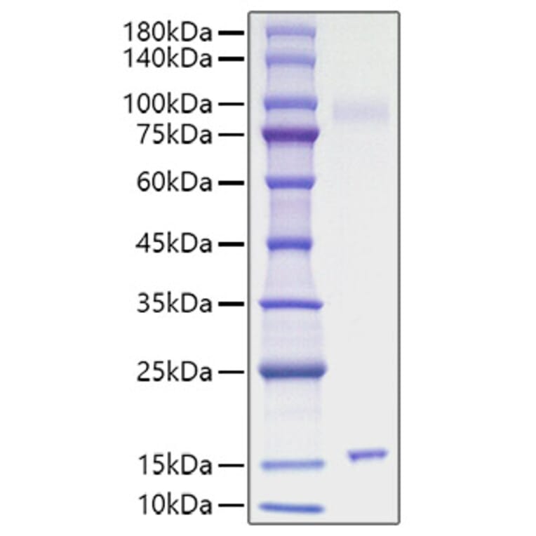 SDS-PAGE - Recombinant Mouse IL-15 Protein (C-terminal His Tag) (A330819) - Antibodies.com