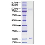 SDS-PAGE - Recombinant Mouse IL-15 Protein (C-terminal His Tag) (A330819) - Antibodies.com