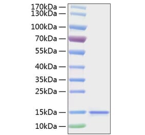 SDS-PAGE - Recombinant Human IL-15 Protein (C-terminal His Tag) (A330820) - Antibodies.com