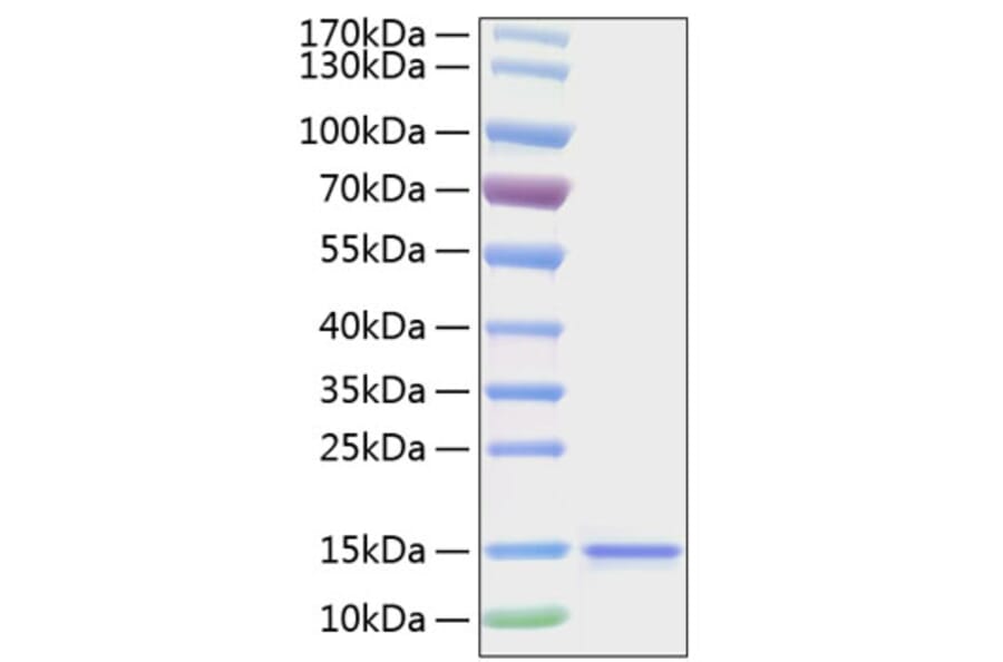 SDS-PAGE - Recombinant Human IL-15 Protein (C-terminal His Tag) (A330820) - Antibodies.com