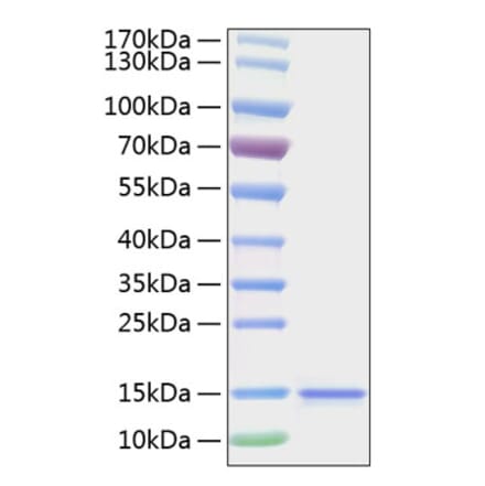 SDS-PAGE - Recombinant Human IL-15 Protein (C-terminal His Tag) (A330820) - Antibodies.com
