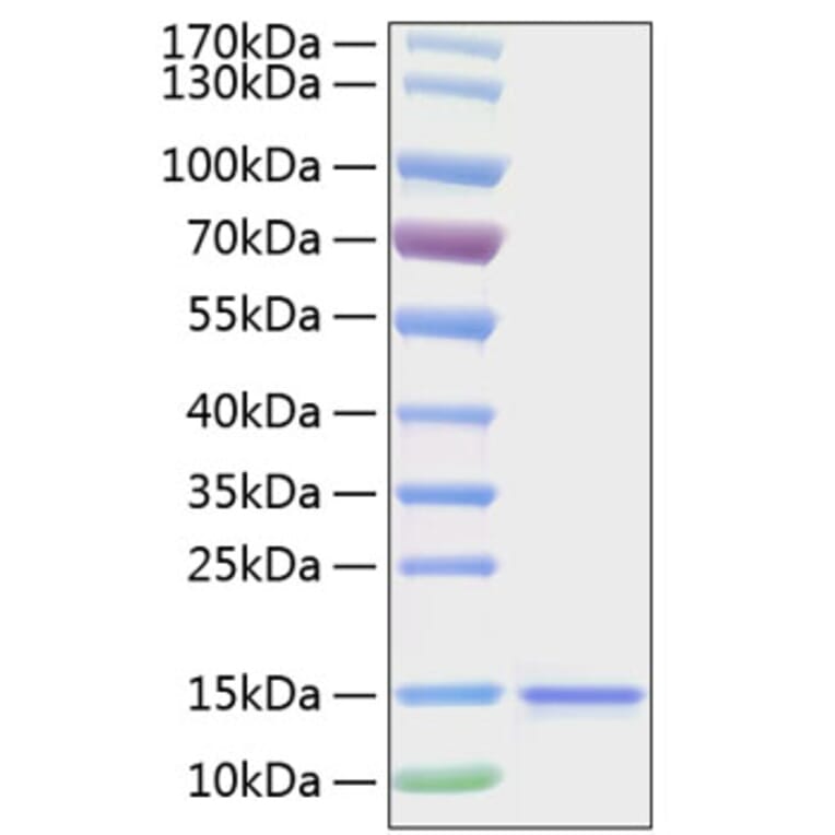 SDS-PAGE - Recombinant Human IL-15 Protein (C-terminal His Tag) (A330820) - Antibodies.com
