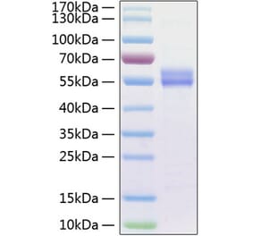 SDS-PAGE - Recombinant Human IL-15 Protein (C-terminal Human Fc and His Tag) (A330821) - Antibodies.com