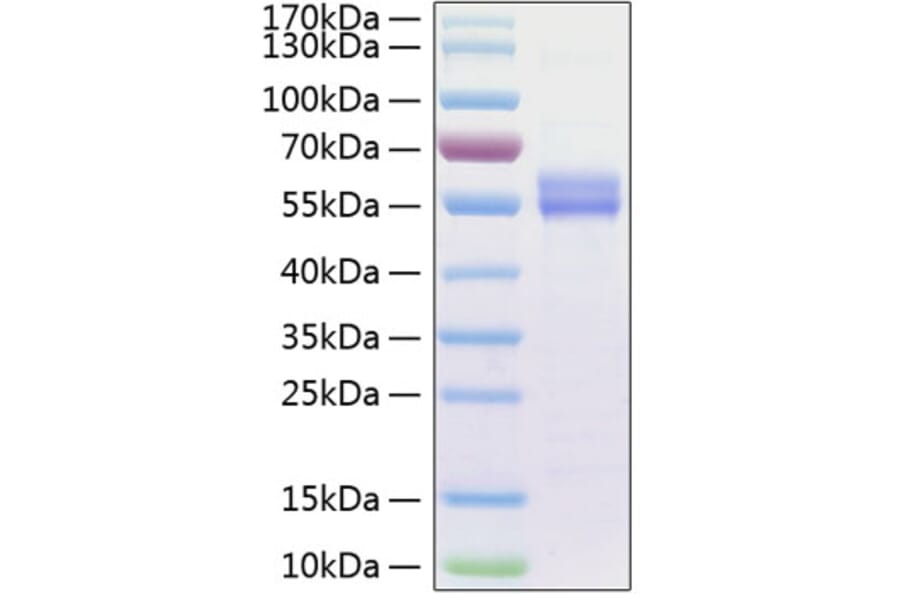 SDS-PAGE - Recombinant Human IL-15 Protein (C-terminal Human Fc and His Tag) (A330821) - Antibodies.com