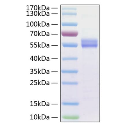 SDS-PAGE - Recombinant Human IL-15 Protein (C-terminal Human Fc and His Tag) (A330821) - Antibodies.com