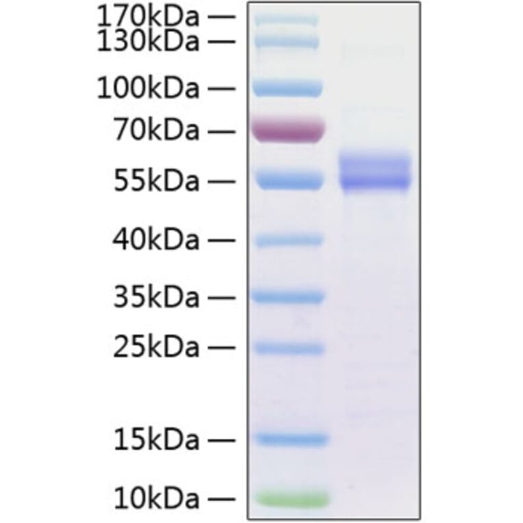 SDS-PAGE - Recombinant Human IL-15 Protein (C-terminal Human Fc and His Tag) (A330821) - Antibodies.com