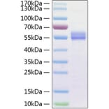 SDS-PAGE - Recombinant Human IL-15 Protein (C-terminal Human Fc and His Tag) (A330821) - Antibodies.com