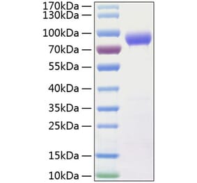 SDS-PAGE - Recombinant Human IL-15RA Protein (C-terminal Human Fc and His Tag) (A330822) - Antibodies.com