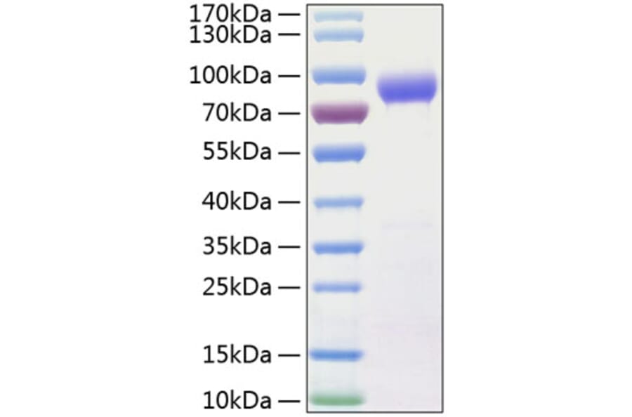 SDS-PAGE - Recombinant Human IL-15RA Protein (C-terminal Human Fc and His Tag) (A330822) - Antibodies.com