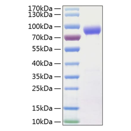 SDS-PAGE - Recombinant Human IL-15RA Protein (C-terminal Human Fc and His Tag) (A330822) - Antibodies.com