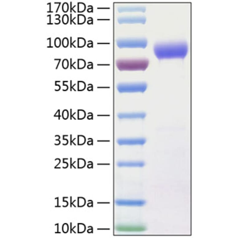 SDS-PAGE - Recombinant Human IL-15RA Protein (C-terminal Human Fc and His Tag) (A330822) - Antibodies.com