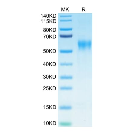 Tris-Bis PAGE - Recombinant Human IL-15RA Protein (Biotin) (C-terminal His and Avi Tag) (A330823) - Antibodies.com