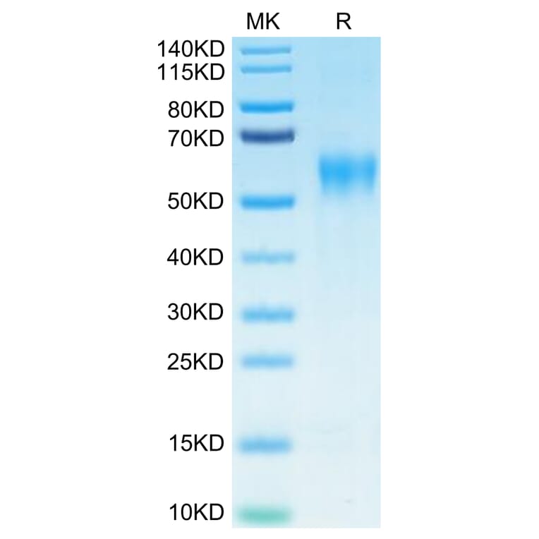 Tris-Bis PAGE - Recombinant Human IL-15RA Protein (Biotin) (C-terminal His and Avi Tag) (A330823) - Antibodies.com