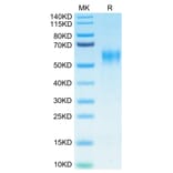 Tris-Bis PAGE - Recombinant Human IL-15RA Protein (Biotin) (C-terminal His and Avi Tag) (A330823) - Antibodies.com