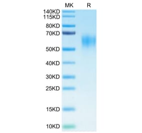 Tris-Bis PAGE - Recombinant Human IL-15RA Protein (C-terminal His and Avi Tag) (A330824) - Antibodies.com